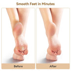 Instant Electric Callus Remover