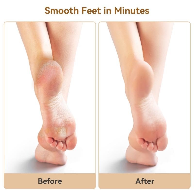 Instant Electric Callus Remover