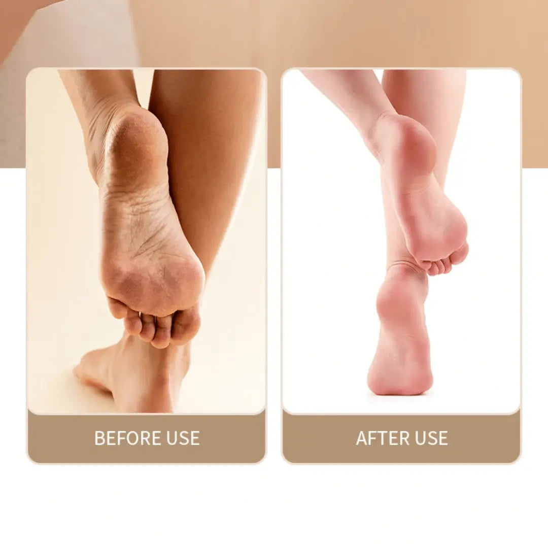 SmoothStep Rechargeable Foot File